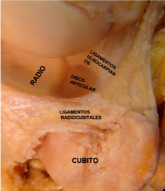 Componentes del Ligamento Fibrocartílago Triangular