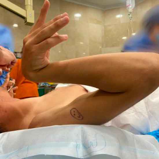 Niño con espasticidad en el codo