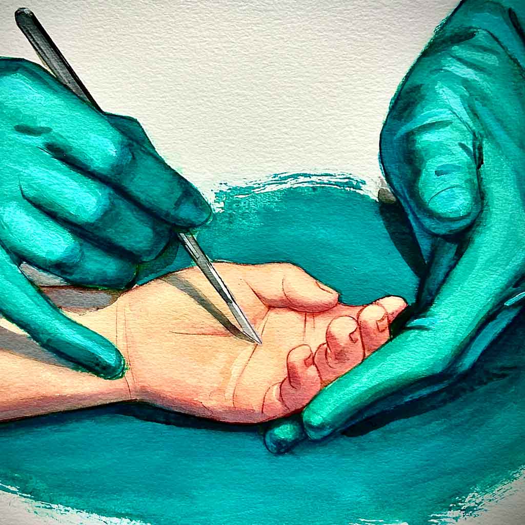 Unidad de cirugía de la mano y muñeca de Madrid